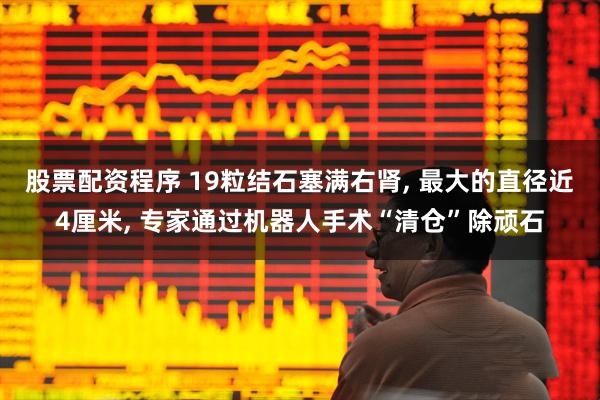 股票配资程序 19粒结石塞满右肾, 最大的直径近4厘米, 专家通过机器人手术“清仓”除顽石